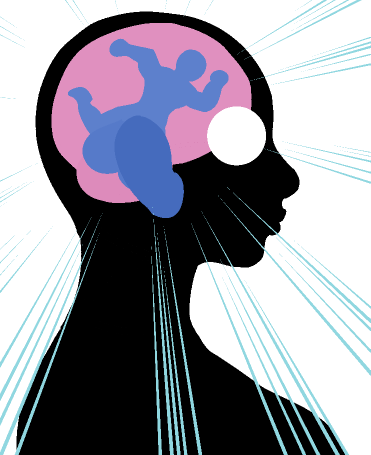 File:BrainMount2.png